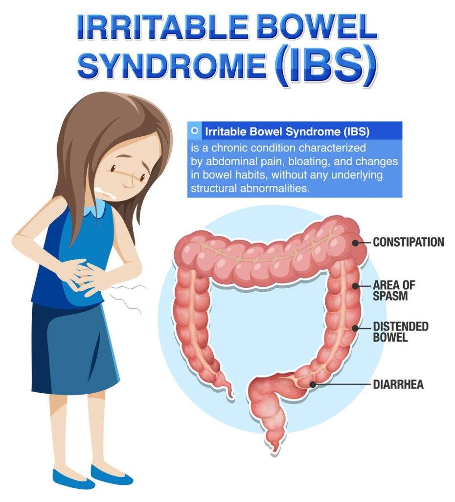 Irritable bowel syndrome IBS diagram showing constipation diarrhea and abdominal pain treated by gastroenterologist in Raipur