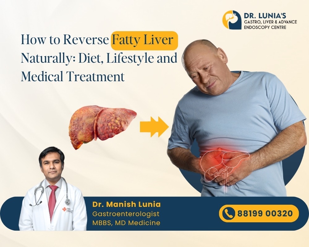 How to Reverse Fatty Liver Naturally: Diet, Lifestyle and Medical Treatment